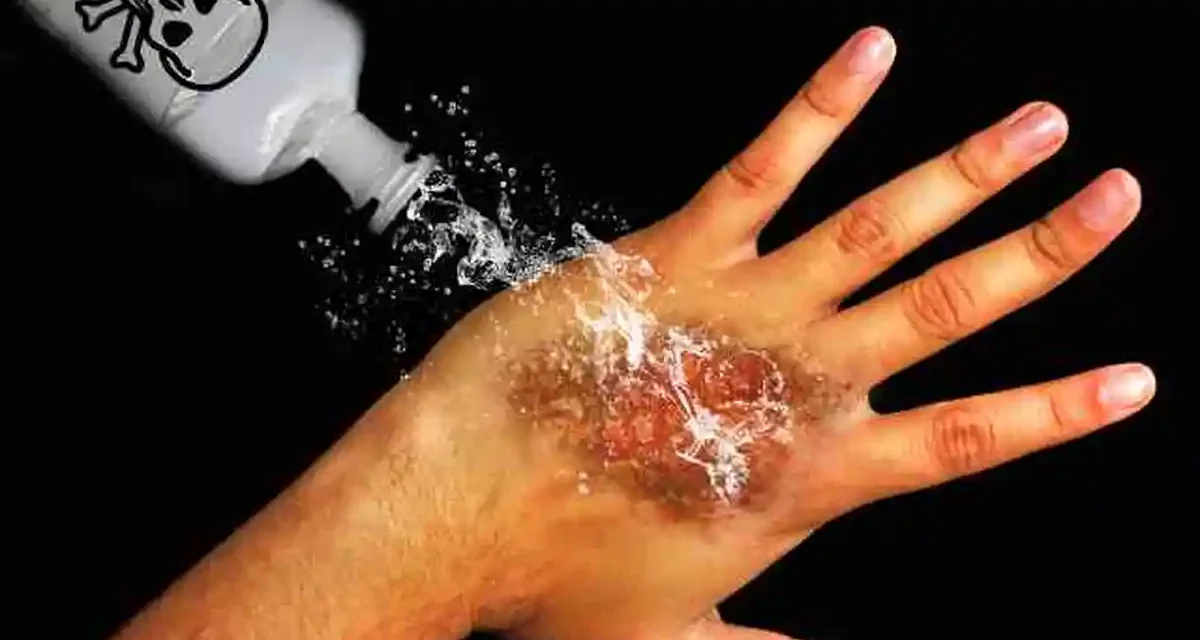 Bahan Kimia Cairan Air Keras Yang Berbahaya