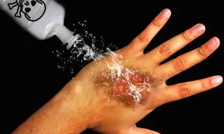 Bahan Kimia Cairan Air Keras Yang Berbahaya