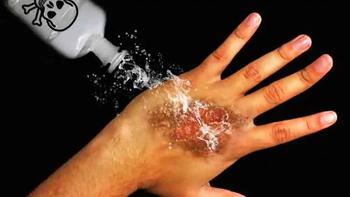 Bahan Kimia Cairan Air Keras Yang Berbahaya