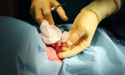 Prosedur Medis Sunat Untuk Kebersihan Dan Kesucian